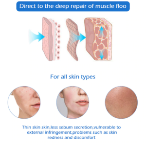 Electric Micro Needling Pen - Image 2