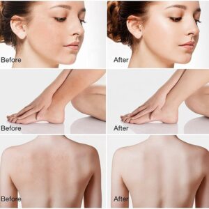 Coffee Scrub Body Scrub Cream Facial Dead Sea Salt Exfoliating Whitening Moisturizing Anti Cellulite Treatment Acne - Image 6