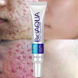 Effective Acne Removal Cream Acne Treatment Fade Acne Spots Oil Control Anti-Acne Shrink Pores Whiten Face Gel Skin Care