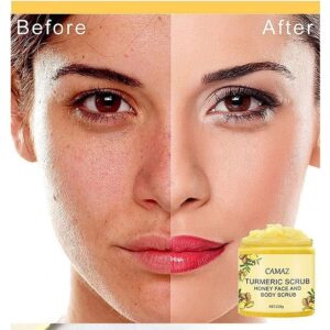 Turmeric Scrub 250g Can Remove Dead Skin on The Face and Body Deeply Cleanse The Stratum Corneum and Relieve Facial Dullness - Image 2